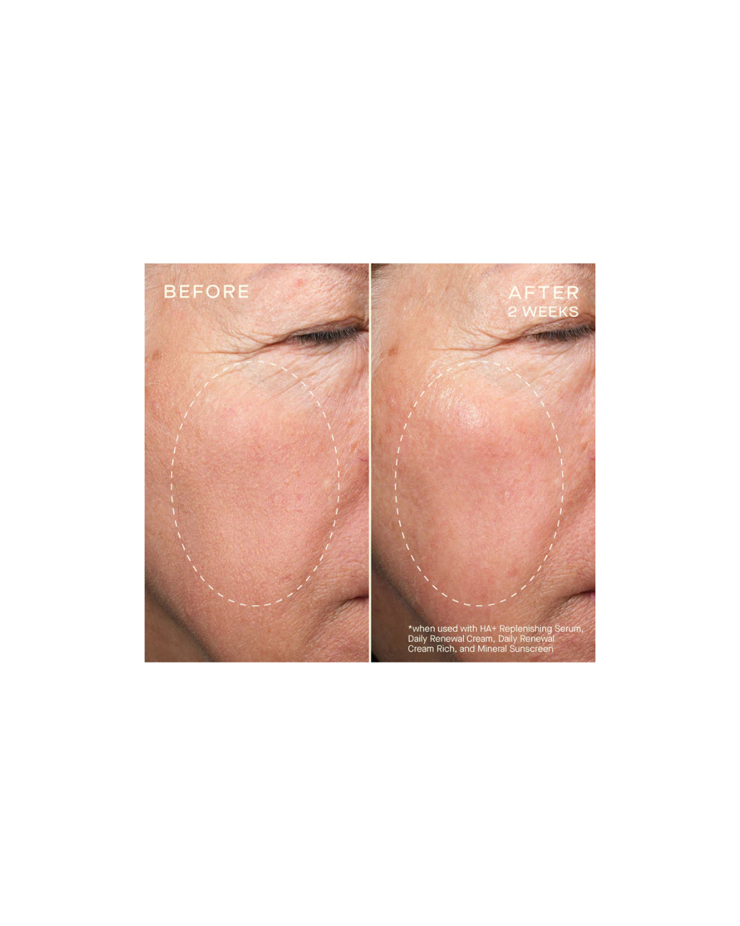 Ourself Advanced Regenerative Serum
