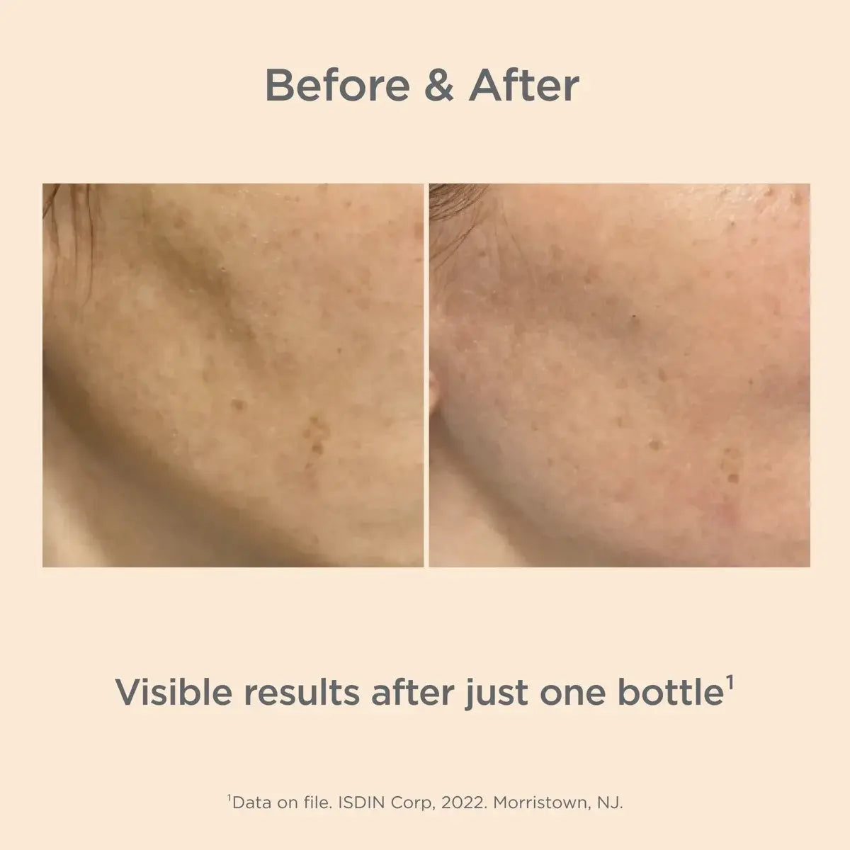 Isdin Melaclear Advanced