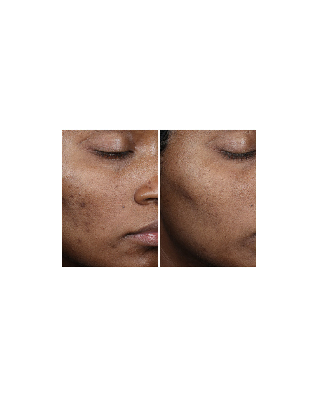 Ourself Complexion Brightening Serum