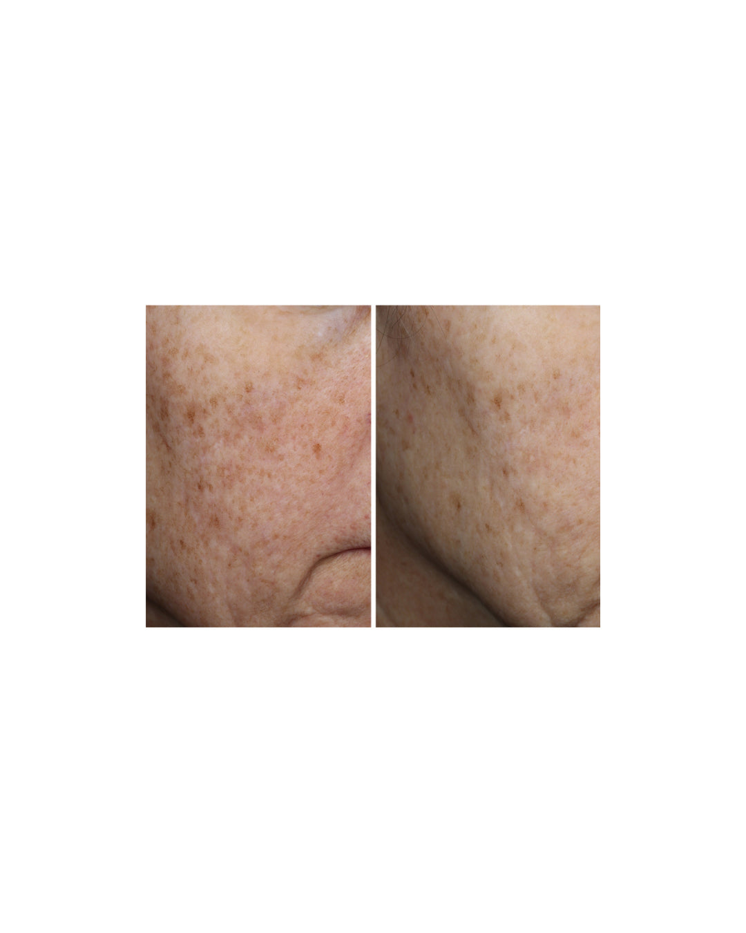 Ourself Complexion Brightening Serum