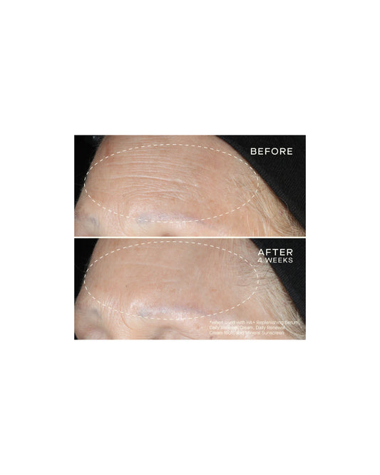 Ourself HA Replenishing Serum