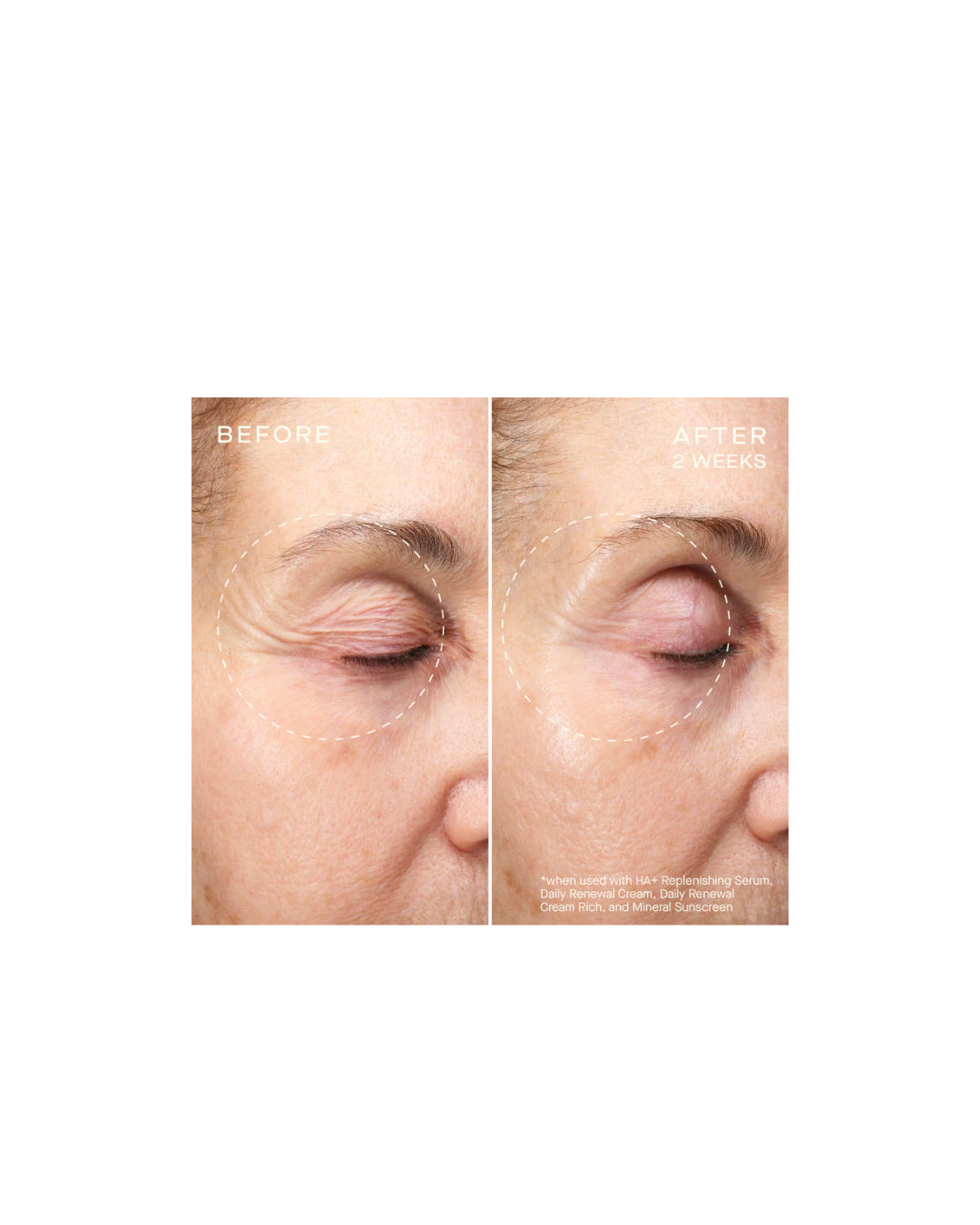 Ourself Advanced Regenerative Serum