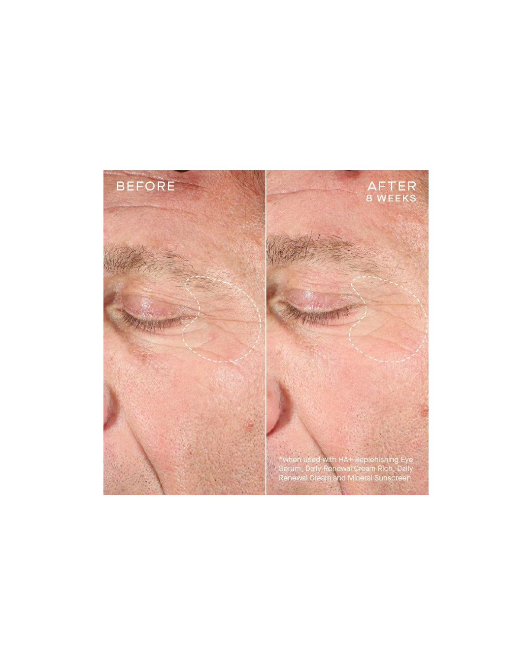 Ourself HA + Replenishing Eye Serum