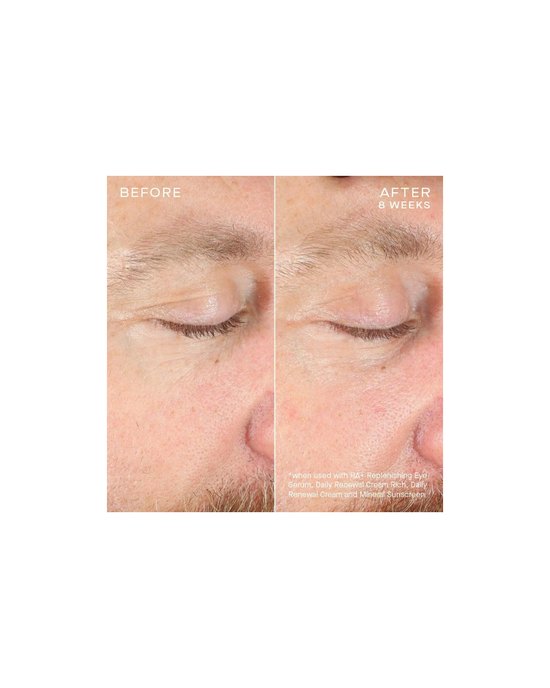 Ourself HA + Replenishing Eye Serum