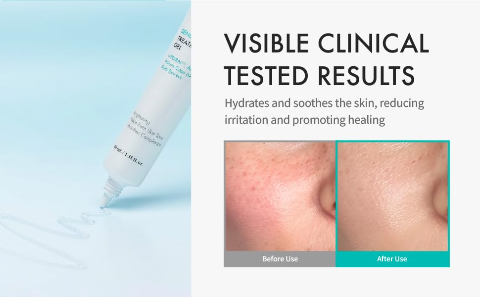 Rejuran Advanced Scar Gel